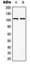 Glutamate Metabotropic Receptor 8 antibody, MBS820400, MyBioSource, Western Blot image 