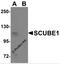 Signal peptide, CUB and EGF-like domain-containing protein 1 antibody, 5843, ProSci, Western Blot image 