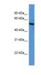 Alpha-ketoglutarate-dependent dioxygenase FTO antibody, NBP1-69021, Novus Biologicals, Western Blot image 