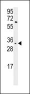 Killer Cell Immunoglobulin Like Receptor, Two Ig Domains And Short Cytoplasmic Tail 3 antibody, LS-C165532, Lifespan Biosciences, Western Blot image 