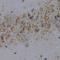 Protein Phosphatase 1 Regulatory Inhibitor Subunit 1B antibody, A2580, ABclonal Technology, Immunohistochemistry paraffin image 