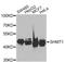 Serine Hydroxymethyltransferase 1 antibody, A7727, ABclonal Technology, Western Blot image 