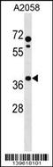 Pleckstrin Homology Like Domain Family A Member 1 antibody, 60-171, ProSci, Western Blot image 