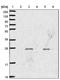 Signal Regulatory Protein Beta 2 antibody, NBP2-33512, Novus Biologicals, Western Blot image 