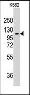 Alanyl-TRNA Synthetase antibody, AP14199PU-N, Origene, Western Blot image 