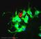 Sodium Voltage-Gated Channel Alpha Subunit 9 antibody, ab65167, Abcam, Immunocytochemistry image 