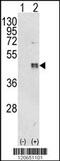 CCAAT Enhancer Binding Protein Beta antibody, MBS9204875, MyBioSource, Western Blot image 