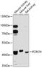 Probable protein-cysteine N-palmitoyltransferase porcupine antibody, A03268, Boster Biological Technology, Western Blot image 