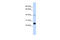 Selenoprotein S antibody, 26-281, ProSci, Western Blot image 