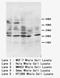 Apolipoprotein A1 antibody, LS-C172078, Lifespan Biosciences, Western Blot image 