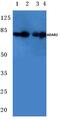 Adenosine Deaminase RNA Specific B1 antibody, PA5-36179, Invitrogen Antibodies, Western Blot image 