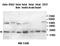 Cyclin-dependent kinase inhibitor 2A, isoforms 1/2/3 antibody, orb77564, Biorbyt, Western Blot image 