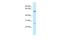 Tetratricopeptide Repeat Domain 39B antibody, A13852, Boster Biological Technology, Western Blot image 