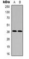 Sphingosine-1-Phosphate Receptor 2 antibody, orb319083, Biorbyt, Western Blot image 