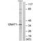 G Protein Subunit Alpha Transducin 1 antibody, A04598, Boster Biological Technology, Western Blot image 