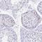 EZH Inhibitory Protein antibody, NBP2-47498, Novus Biologicals, Immunohistochemistry frozen image 