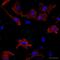 Troponin I3, Cardiac Type antibody, ab47003, Abcam, Immunofluorescence image 