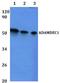 ADAM Like Decysin 1 antibody, A10260, Boster Biological Technology, Western Blot image 