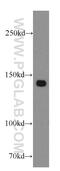Zinc Finger And BTB Domain Containing 40 antibody, 20026-1-AP, Proteintech Group, Western Blot image 