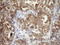 TARBP2 Subunit Of RISC Loading Complex antibody, LS-C791662, Lifespan Biosciences, Immunohistochemistry paraffin image 