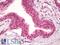 Zinc Finger Protein 652 antibody, 42-907, ProSci, Enzyme Linked Immunosorbent Assay image 