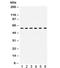 UPF3B Regulator Of Nonsense Mediated MRNA Decay antibody, R32318, NSJ Bioreagents, Western Blot image 