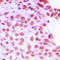 Flap Structure-Specific Endonuclease 1 antibody, LS-C352190, Lifespan Biosciences, Immunohistochemistry paraffin image 