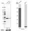 ELOVL Fatty Acid Elongase 5 antibody, NBP2-33500, Novus Biologicals, Western Blot image 