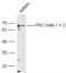 PKC antibody, orb11277, Biorbyt, Western Blot image 