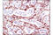 Myristoylated Alanine Rich Protein Kinase C Substrate antibody, 5607P, Cell Signaling Technology, Immunohistochemistry paraffin image 