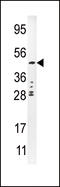 Plasminogen Activator, Urokinase antibody, MBS9210726, MyBioSource, Western Blot image 