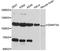 DNA Methyltransferase 3 Alpha antibody, A11791, ABclonal Technology, Western Blot image 