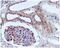 IQ Motif Containing GTPase Activating Protein 1 antibody, ab133490, Abcam, Immunohistochemistry paraffin image 