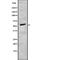 Adrenoceptor Alpha 1B antibody, abx148032, Abbexa, Western Blot image 