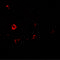 Interleukin 1 Receptor Like 2 antibody, 7501, ProSci, Immunofluorescence image 