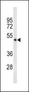 Tryptophan Hydroxylase 2 antibody, TA325096, Origene, Western Blot image 