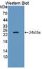GM2 Ganglioside Activator antibody, LS-C373746, Lifespan Biosciences, Western Blot image 