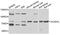 Acyl-CoA Dehydrogenase Very Long Chain antibody, A02607, Boster Biological Technology, Western Blot image 