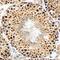 HIF-2-alpha antibody, AF2997, R&D Systems, Immunohistochemistry frozen image 