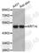 Keratin 14 antibody, A3937, ABclonal Technology, Western Blot image 