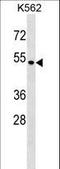 Small ArfGAP 1 antibody, LS-C159040, Lifespan Biosciences, Western Blot image 