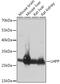 Phospholysine Phosphohistidine Inorganic Pyrophosphate Phosphatase antibody, GTX66250, GeneTex, Western Blot image 