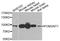 Protein O-Linked Mannose N-Acetylglucosaminyltransferase 1 (Beta 1,2-) antibody, A9879, ABclonal Technology, Western Blot image 