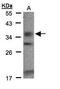 Ephrin B3 antibody, PA5-28831, Invitrogen Antibodies, Western Blot image 