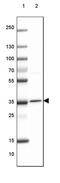 OTU Deubiquitinase, Ubiquitin Aldehyde Binding 1 antibody, PA5-58684, Invitrogen Antibodies, Western Blot image 