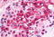 C-X-C Motif Chemokine Receptor 6 antibody, MBS246879, MyBioSource, Immunohistochemistry frozen image 