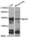 ATP Binding Cassette Subfamily B Member 1 antibody, LS-C408296, Lifespan Biosciences, Western Blot image 