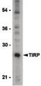 Toll Like Receptor Adaptor Molecule 2 antibody, PA5-20037, Invitrogen Antibodies, Western Blot image 