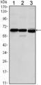 Estrogen Receptor 1 antibody, STJ98054, St John