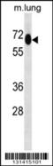 7SK snRNA methylphosphate capping enzyme antibody, 56-855, ProSci, Western Blot image 